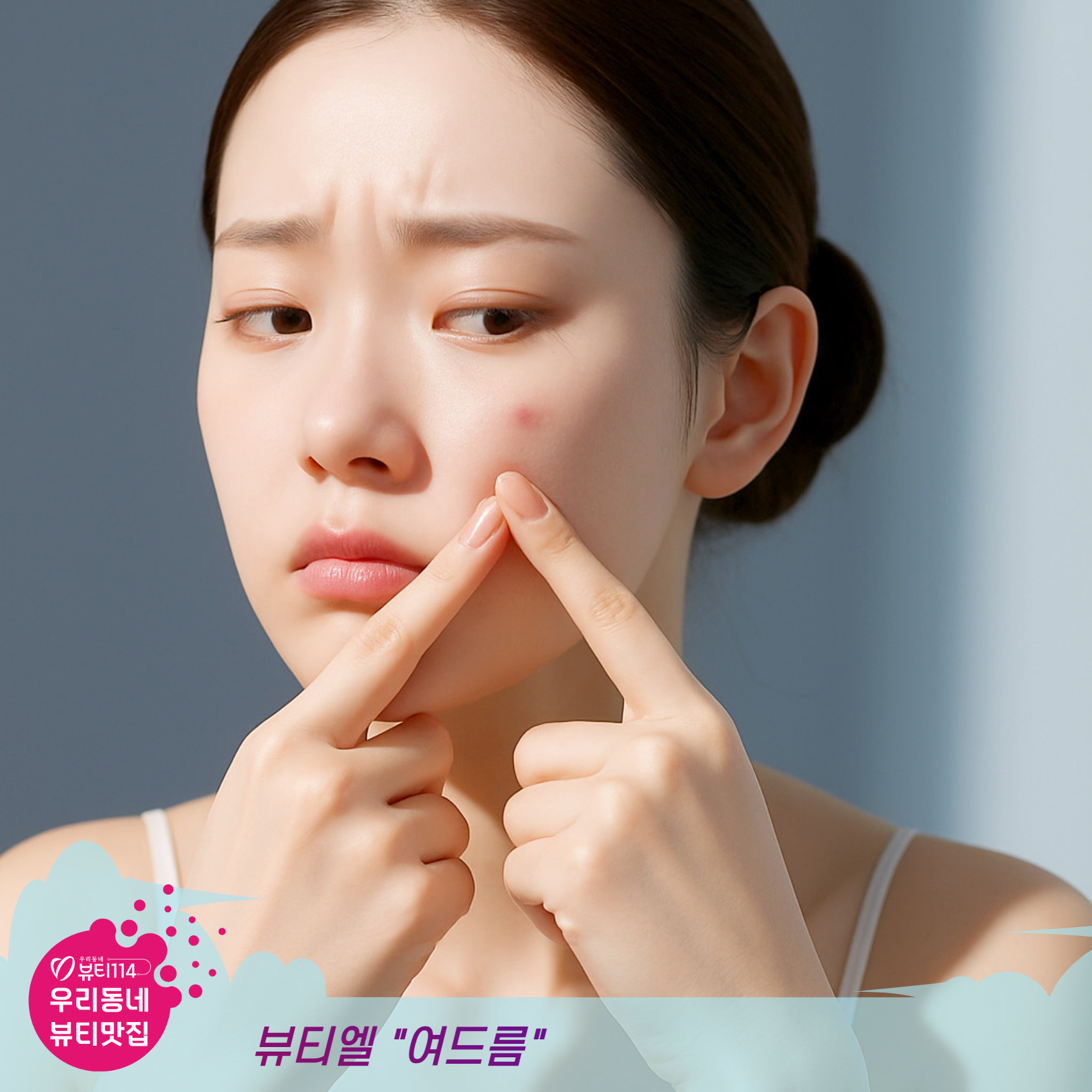 이천 뷰티맛집 여드름관리