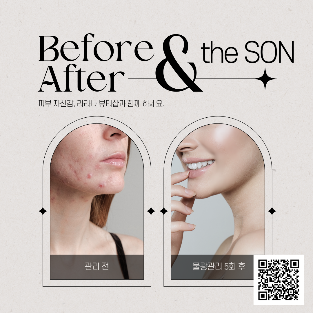 the SON
